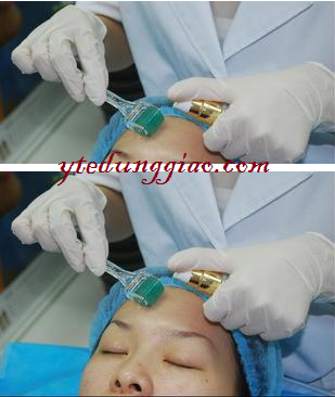 kim lăn trị sẹo rỗ